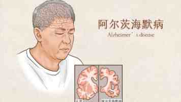 少司缘流眼泪翻白眼流口水表情:出处、含义与使用场景全解析